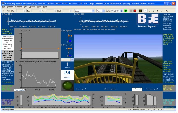 Integrated Neurofeedback [BFE] - Suite 1