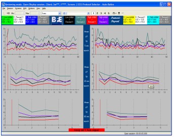 Integrated Neurofeedback [BFE] - Suite 2