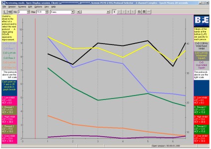 Integrated Neurofeedback [BFE] - Suite 4