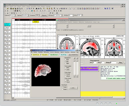 [Mitsar-WinEEG] WinEEG software ADVANCED by MITSAR