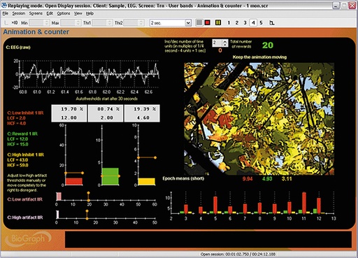 EEG Suite